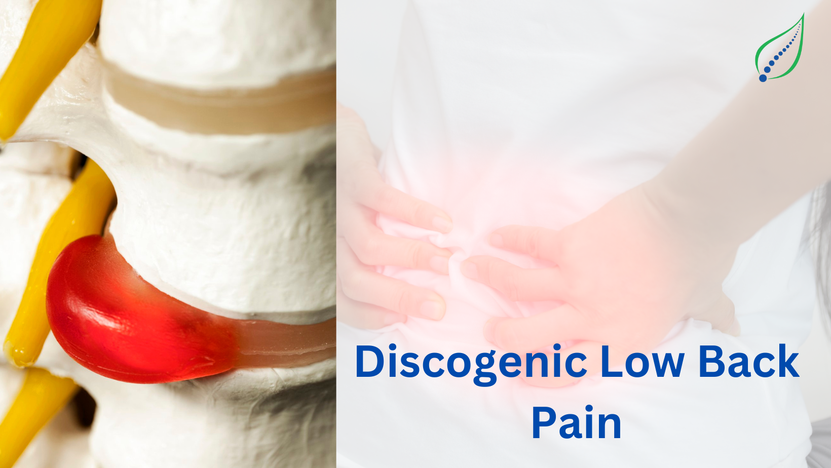 Discogenic Low Back Pain